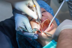 dental extraction recovery timeline what to expect