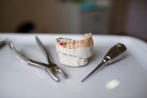 stainless steel vs xirconia crowns for baby teeth which is better